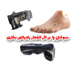 قاب محافظ فلزی لوله رادیاتور بخاری پژو 206 – 207 – رانا